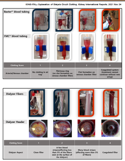visual clotting scale.png