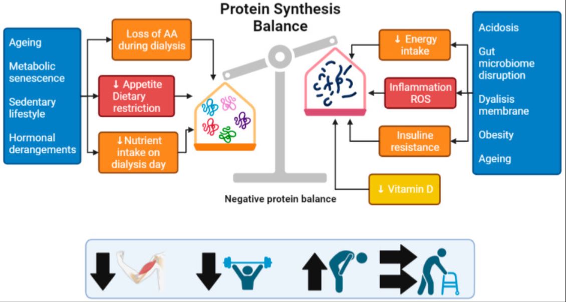 figure1. Etiologic factors leading to muscle loss in chronic kidney disease. (from Nutrients. 2023 Jul 11;15(14)3107.).JPG